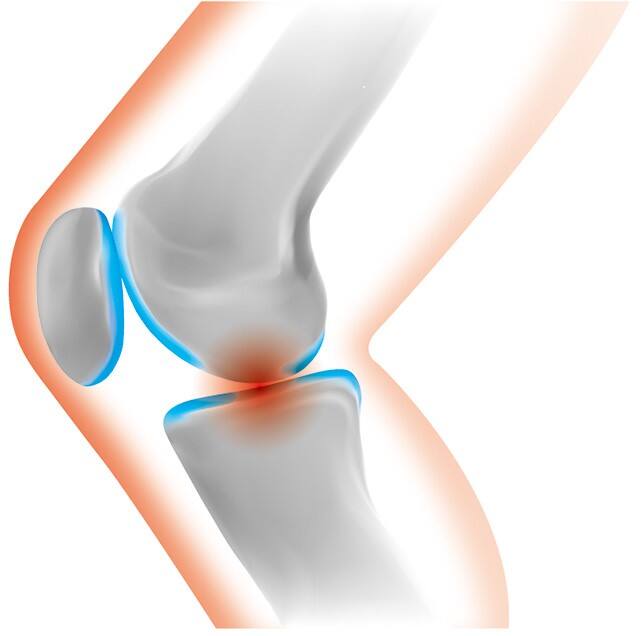 �G�̒ɂ݁A������A���́A����